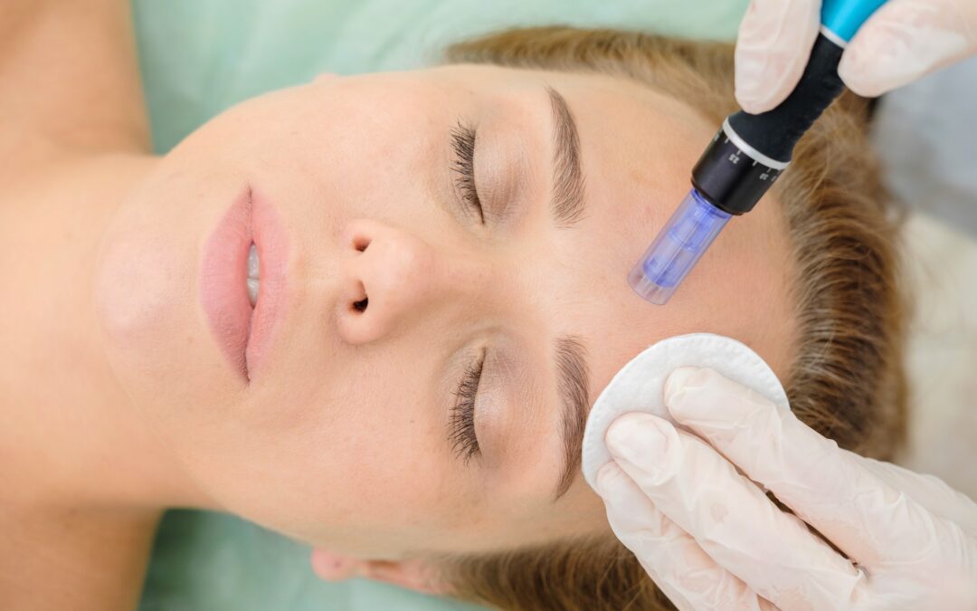 Dermapen – Όλα όσα πρέπει να γνωρίζετε