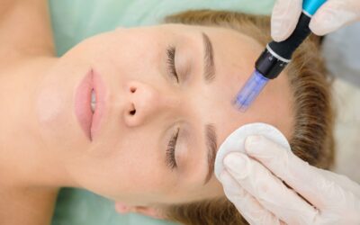Dermapen – Όλα όσα πρέπει να γνωρίζετε