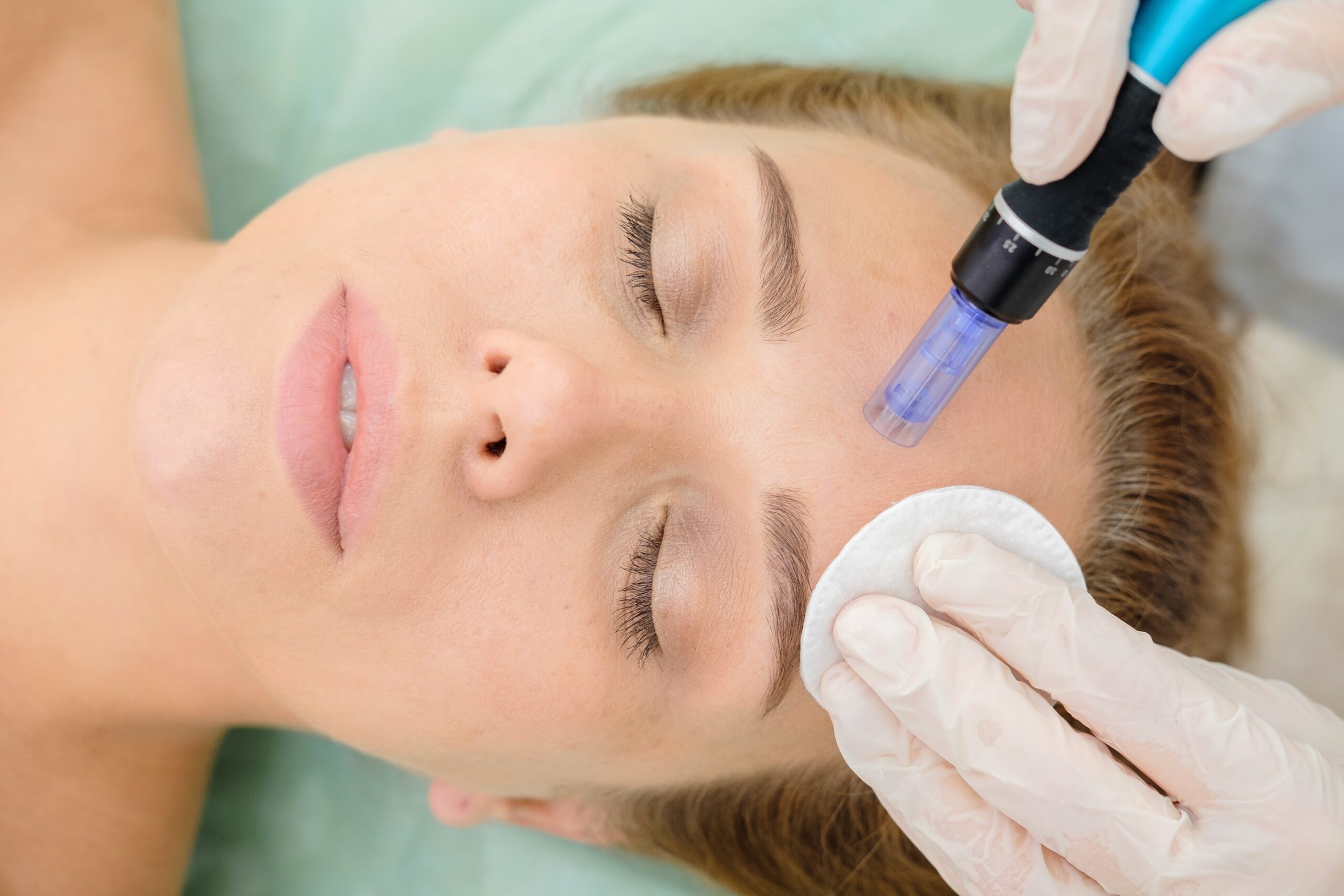 Dermapen